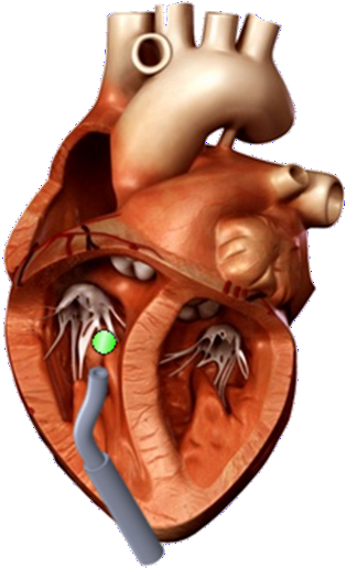 3 D Human Heart Model