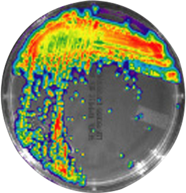 Bacterial Growth Patterns Petri Dish