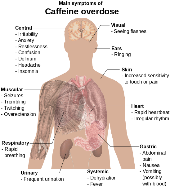 Caffeine Overdose Symptoms Infographic