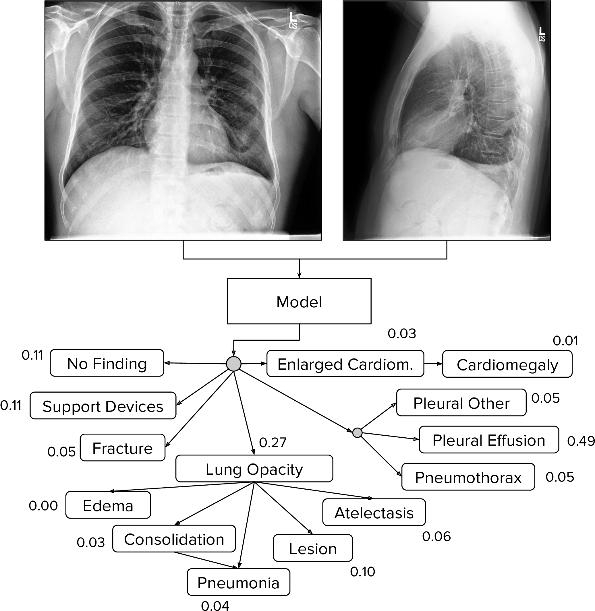 Chest Xray Diagnostic A I Analysis