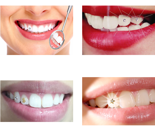 Dental Care Procedures Collage