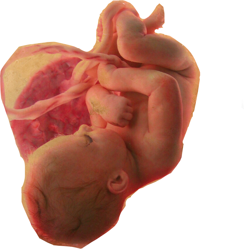 Fetal Developmentin Utero