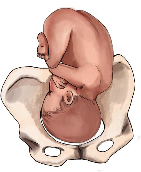 Fetal Positionin Pelvis