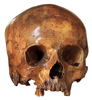 Human Skull Specimen