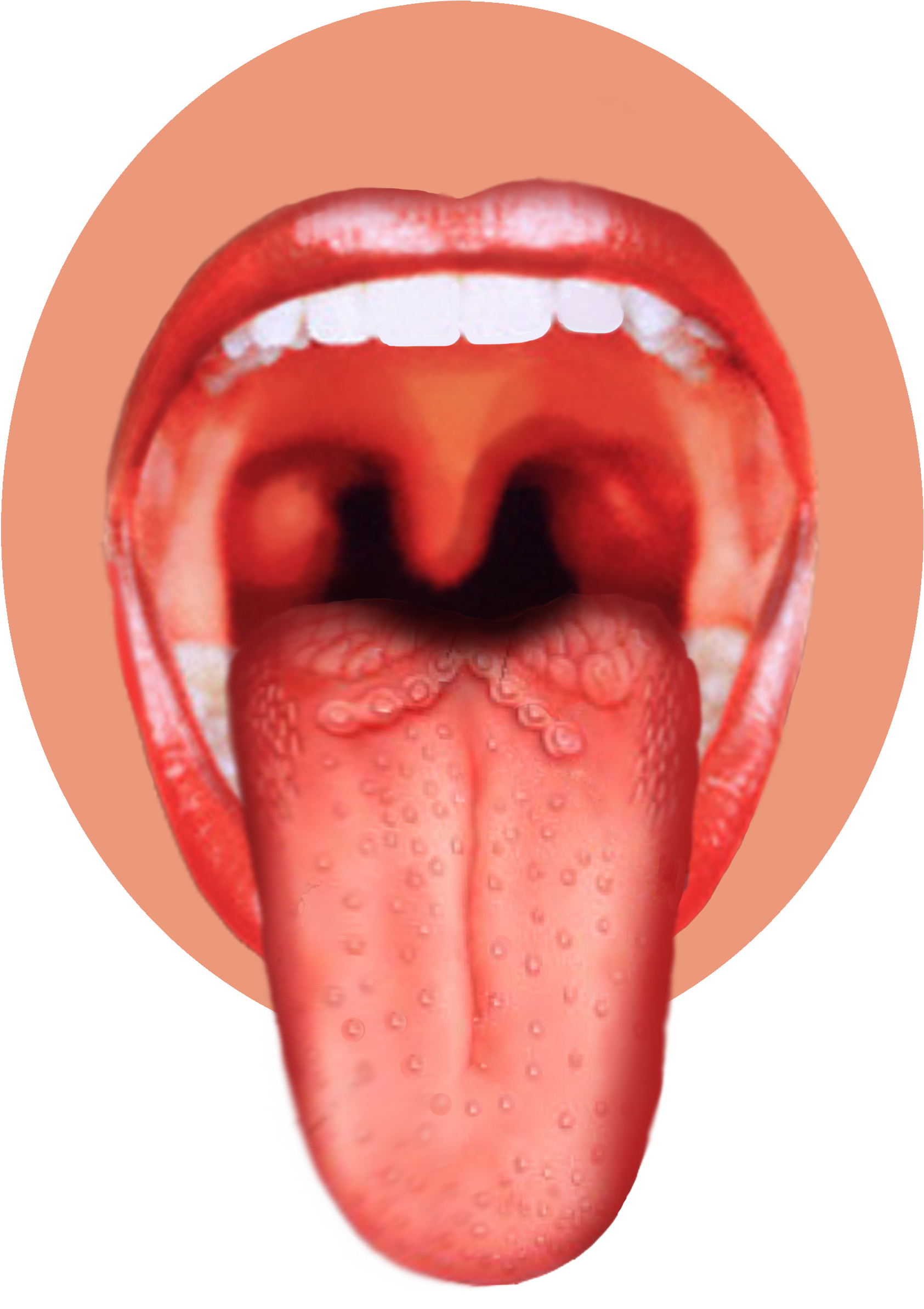 Open Mouthand Tongue View