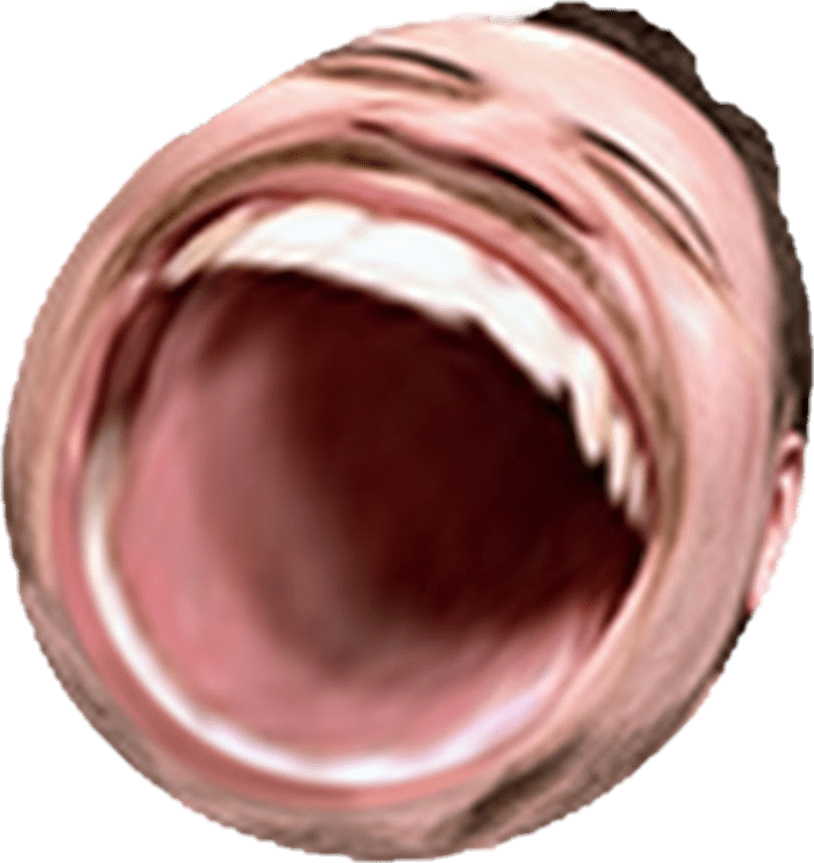 Pog Champ Emote Distorted