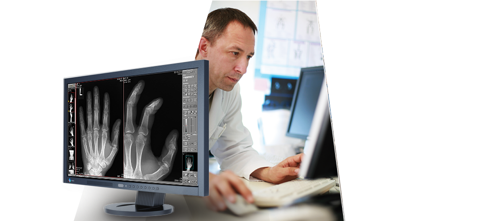 Radiologist Analyzing Hand Xray