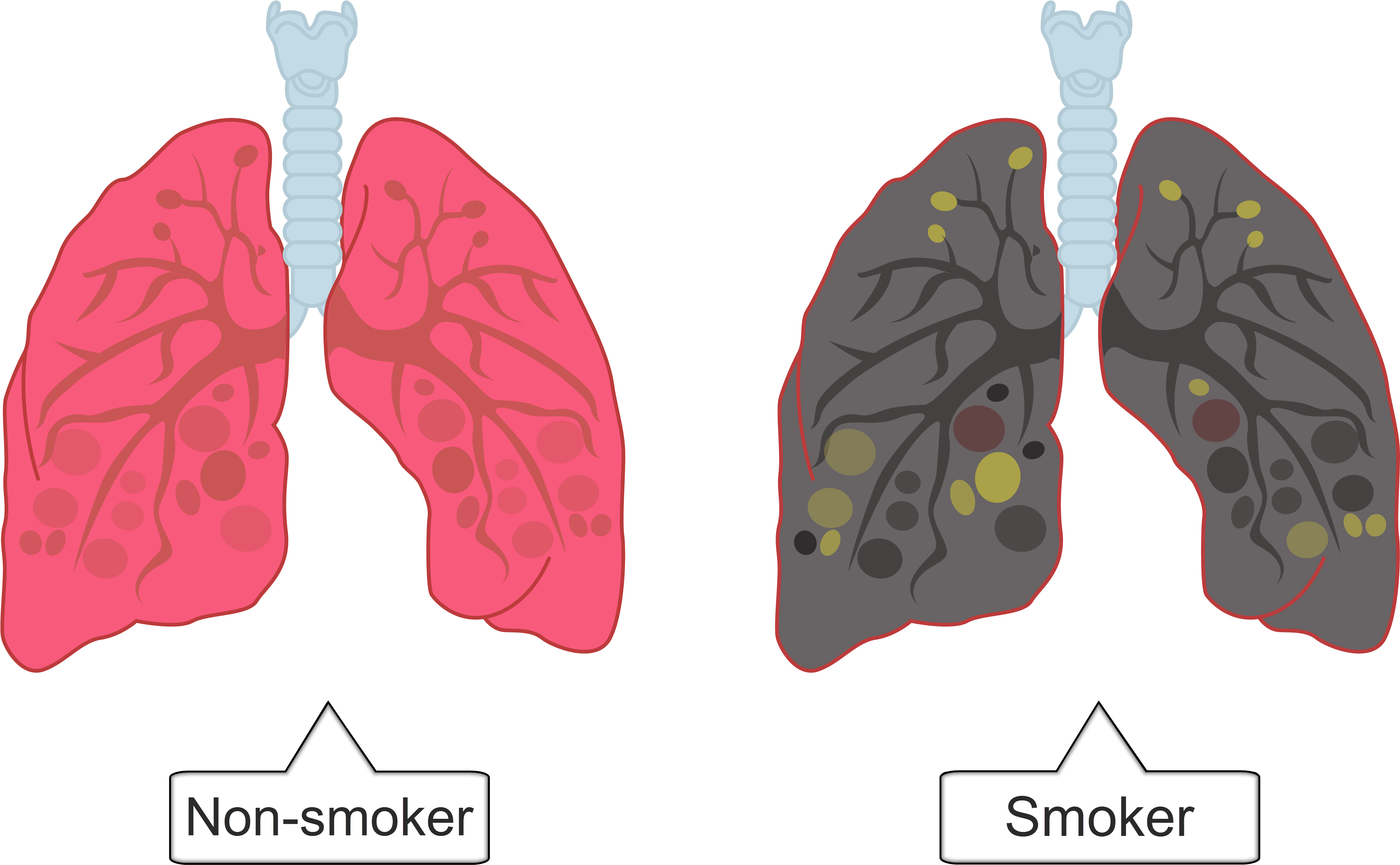 Smokervs Non Smoker Lung Comparison