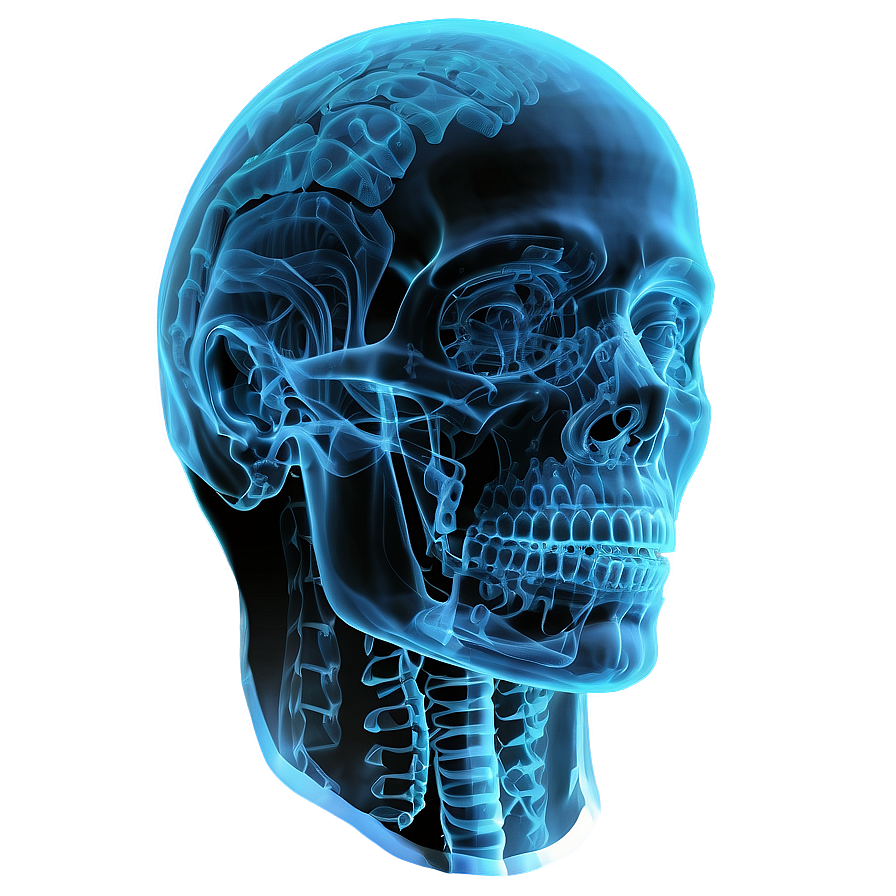 X Ray Of Human Head Png 90