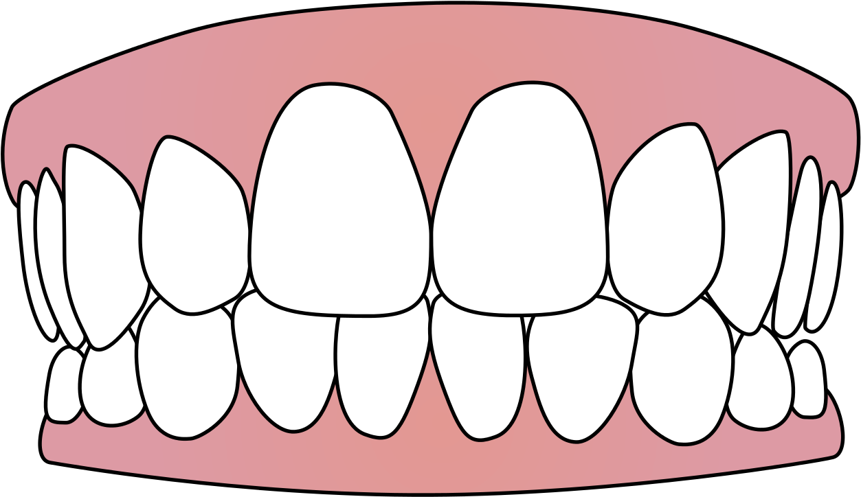 Cartoon Smile Teeth Illustration.png PNG Image