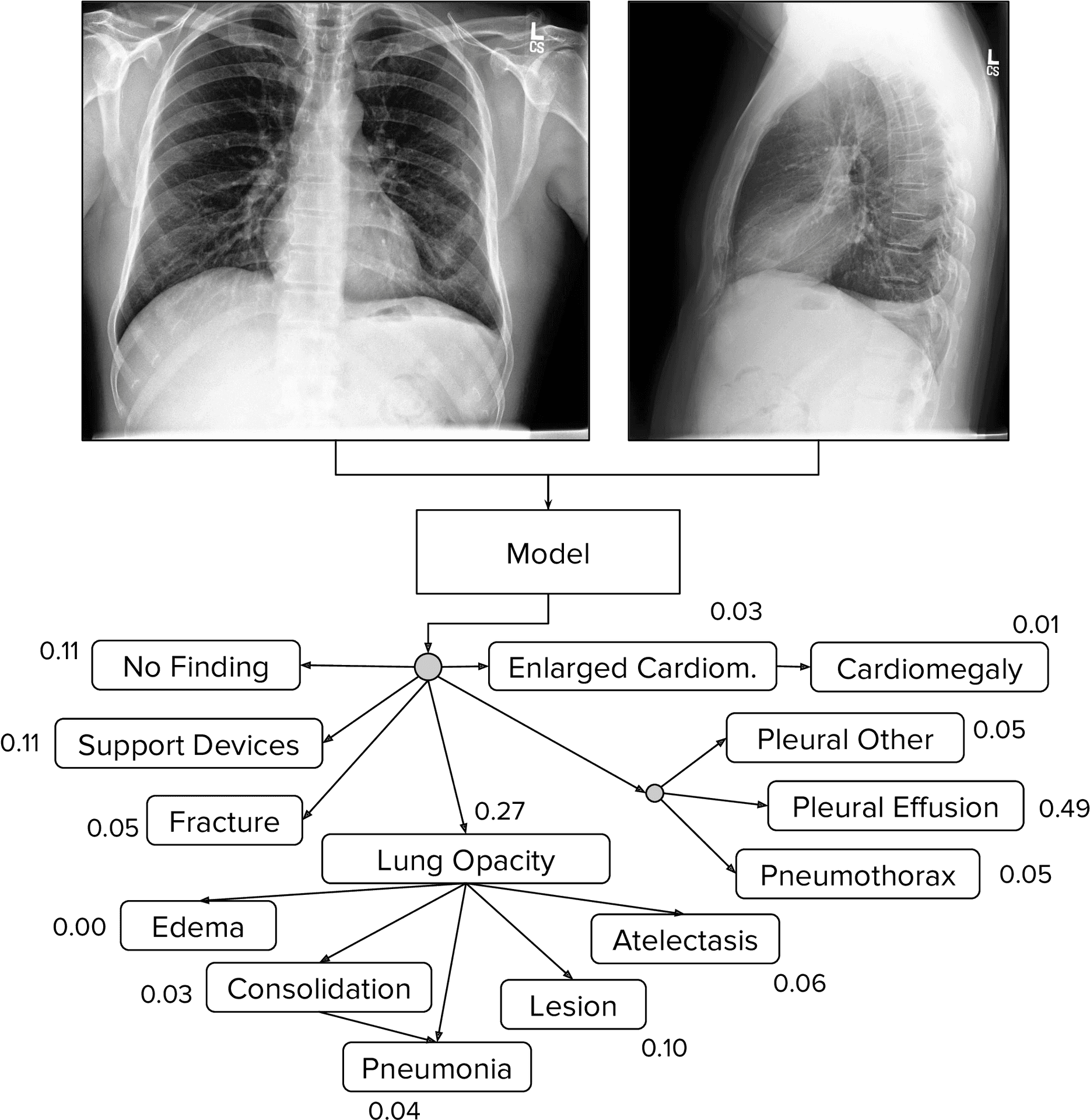 Chest Xray Diagnostic A I Analysis PNG Image