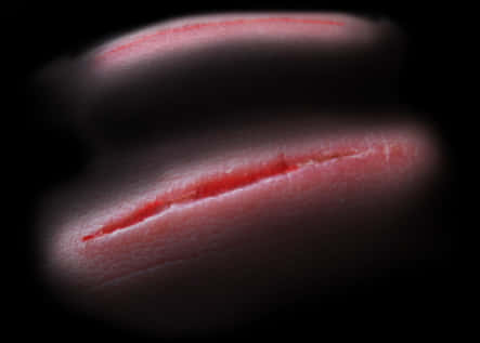 Close Up Healing Scar PNG Image