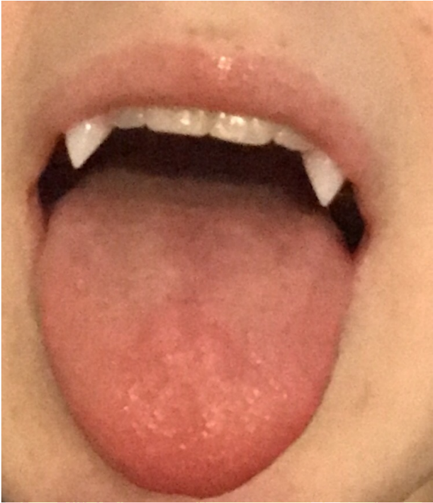 Close Up Tongue Piercing PNG Image