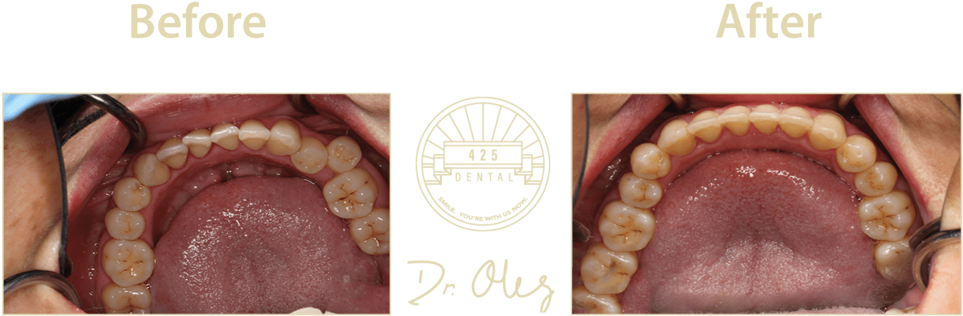 Dental_ Treatment_ Before_ After_ Dr_ Olly PNG Image