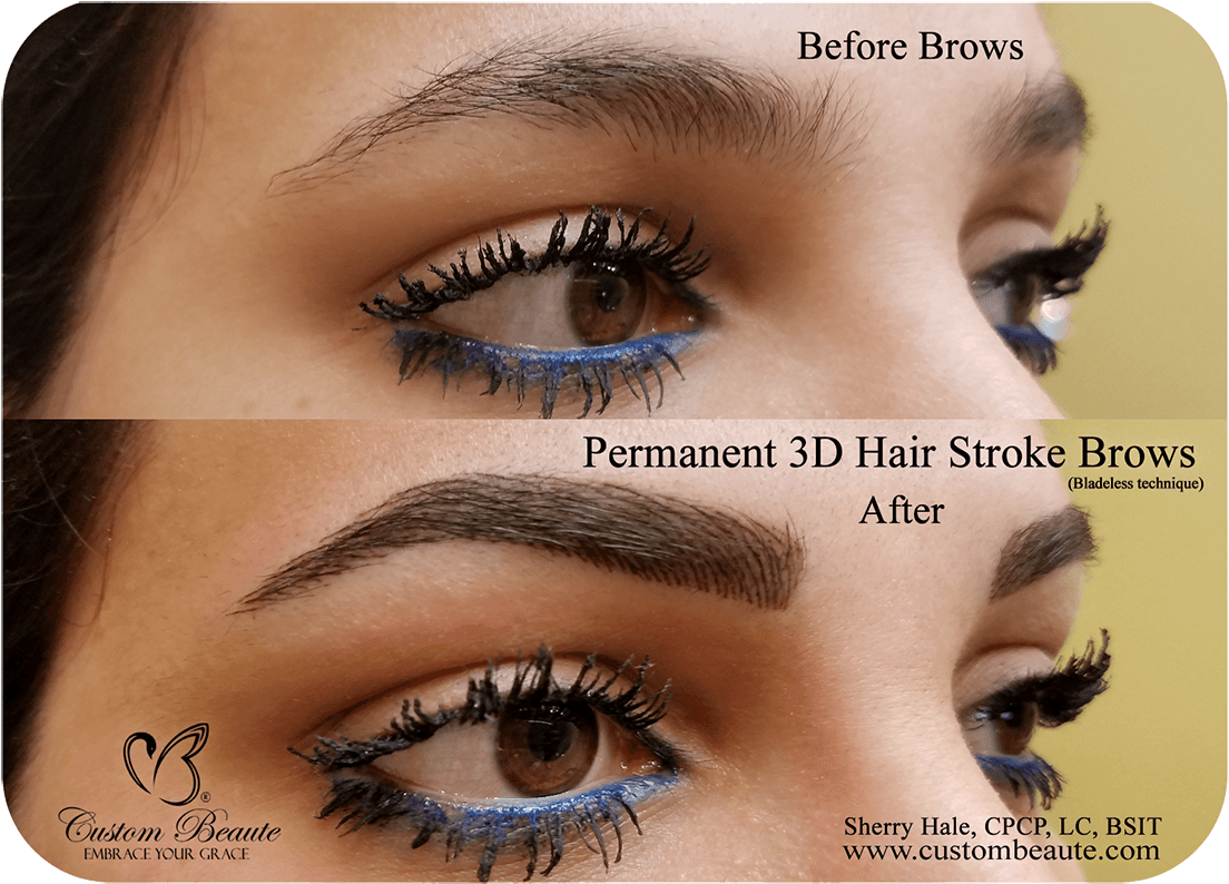 Eyebrow Enhancement Before After PNG Image