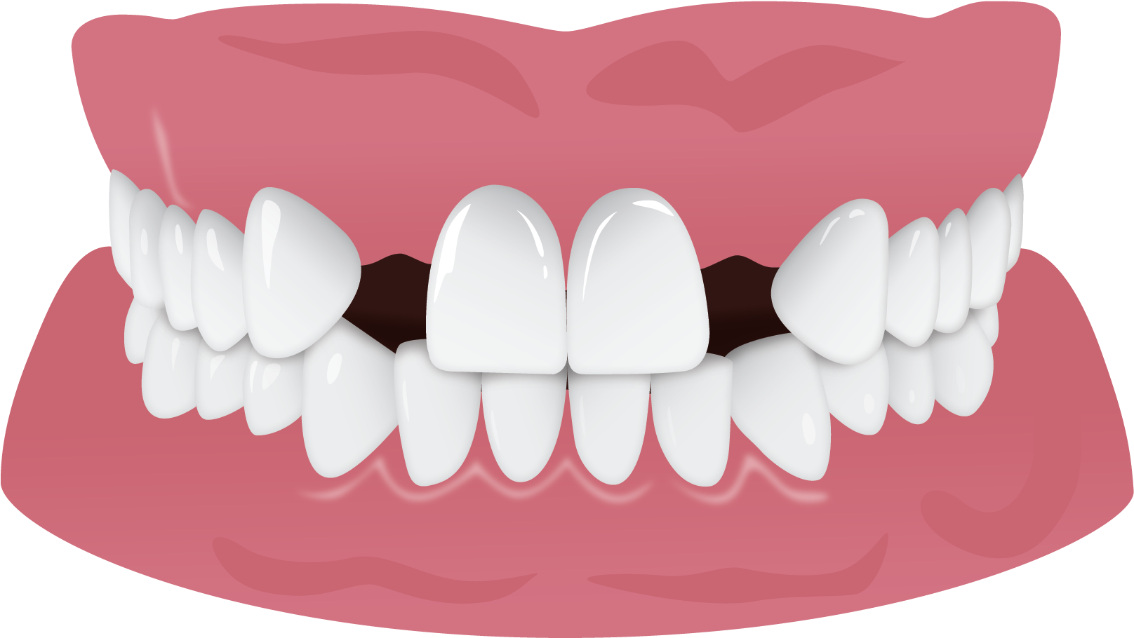 Healthy Teeth Illustration.png PNG Image