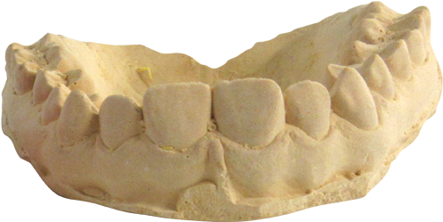 Human Lower Jawbone Model PNG Image