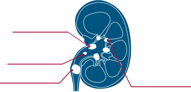 Kidney Anatomy Diagram PNG Image