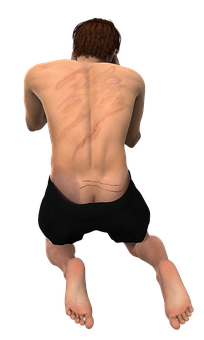 Man Kneeling Back Scars PNG Image