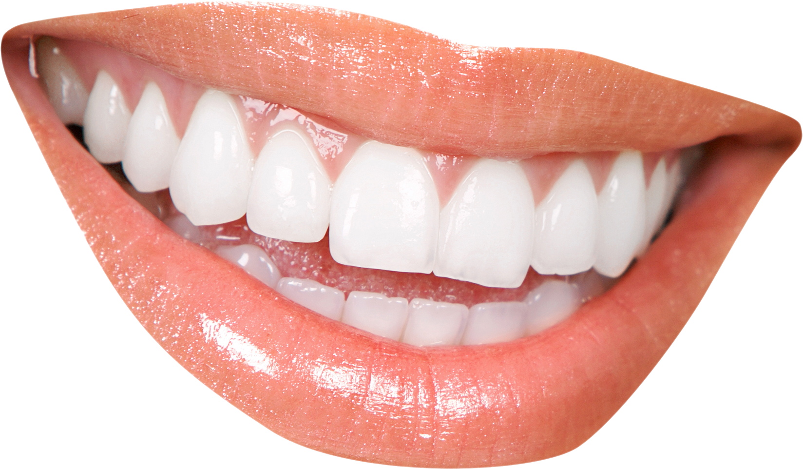 Perfect Smile Close Up PNG Image