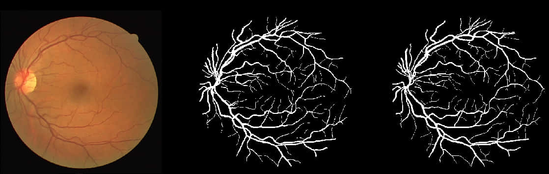 Retinal Imagingand Vascular Extraction PNG Image