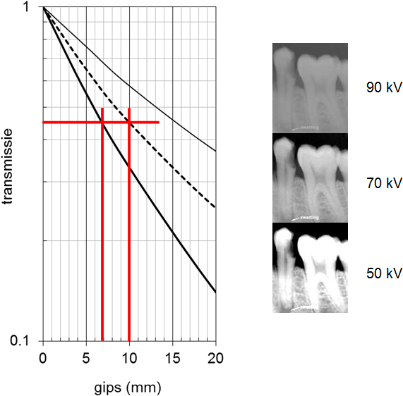 Xray Transmission Graphand Dental Imaging Comparison PNG Image