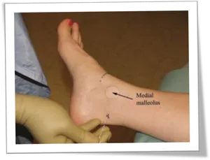 Ankle Injection Demonstration PNG