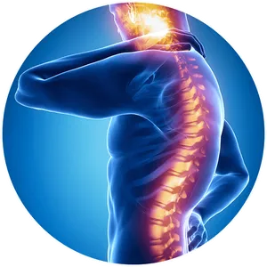 Back_ Pain_ Illustration PNG Image