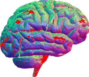 Colorful Brain M R I Scan PNG Image