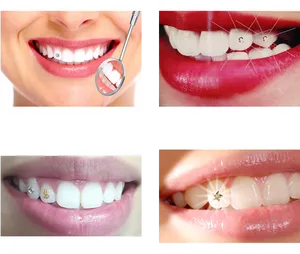 Dental Care Procedures Collage PNG Image