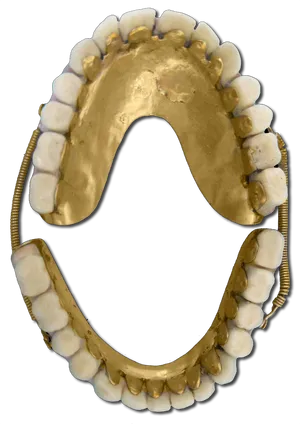 Dental Impression Gold Teeth PNG Image