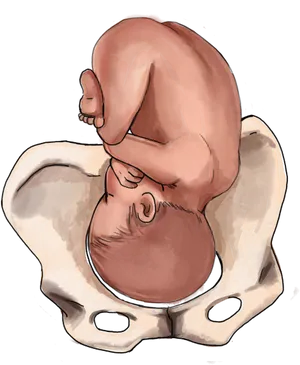 Fetal Positionin Pelvis PNG Image