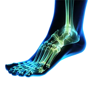 Foot Bones X-ray Png 2 PNG Image