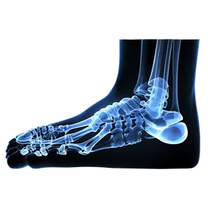 Foot Bones X-ray Png 57 PNG Image