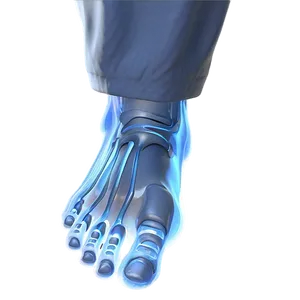 Frostbitten Foot Image Png Rkm PNG Image