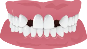 Healthy Teeth Illustration.png PNG Image