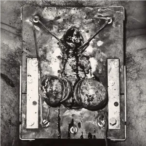 Historic Pacemaker Surgery1960 PNG