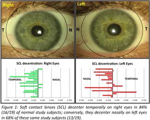 Human Eye Comparison Corneal Topography PNG Image