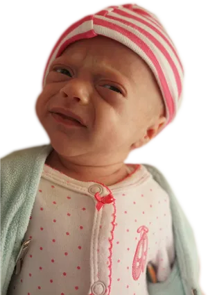 Newborn Baby Facial Expression PNG Image