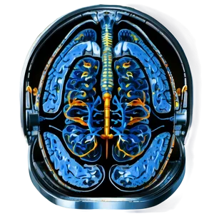 Realistic Mri Image Free Png Shw PNG Image